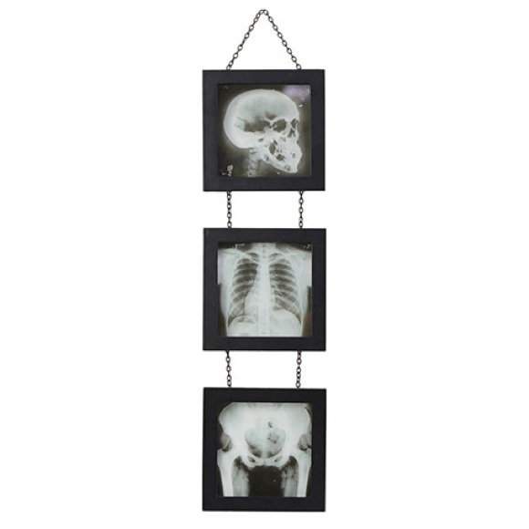 X-Ray Skeleton Wall Decor 18” - Picture 3 of 4